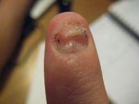 The Finger